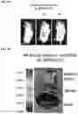 Fig. 21 - COMPOSITIONS AND METHODS FOR TARGETING TUMOR-ASSOCIATED EXTRACELLULAR MATRIX COMPONENTS TO IMPROVE DRUG DELIVERY