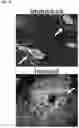 Fig. 22 - COMPOSITIONS AND METHODS FOR TARGETING TUMOR-ASSOCIATED EXTRACELLULAR MATRIX COMPONENTS TO IMPROVE DRUG DELIVERY