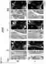Fig. 25 - COMPOSITIONS AND METHODS FOR TARGETING TUMOR-ASSOCIATED EXTRACELLULAR MATRIX COMPONENTS TO IMPROVE DRUG DELIVERY