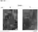 Fig. 27 - COMPOSITIONS AND METHODS FOR TARGETING TUMOR-ASSOCIATED EXTRACELLULAR MATRIX COMPONENTS TO IMPROVE DRUG DELIVERY