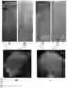 Fig. 32 - COMPOSITIONS AND METHODS FOR TARGETING TUMOR-ASSOCIATED EXTRACELLULAR MATRIX COMPONENTS TO IMPROVE DRUG DELIVERY