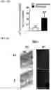 Fig. 33 - COMPOSITIONS AND METHODS FOR TARGETING TUMOR-ASSOCIATED EXTRACELLULAR MATRIX COMPONENTS TO IMPROVE DRUG DELIVERY