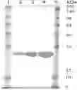 Fig. 01 - COMPOSITION FOR USE IN IMPROVING ENDOTHELIAL FUNCTION BY ENHANCING FLOW MEDIATED DILATION