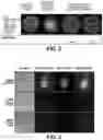 Fig. 03 - METHOD OF TREATING AND PREVENTING BONE AND JOINT INFECTIONS