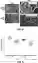 Fig. 04 - METHOD OF TREATING AND PREVENTING BONE AND JOINT INFECTIONS