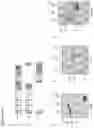 Fig. 14 - METHODS FOR IDENTIFICATION, ASSESSMENT, PREVENTION, AND TREATMENT OF METABOLIC DISORDERS USING SLIT2