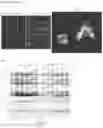 Fig. 29 - METHODS FOR IDENTIFICATION, ASSESSMENT, PREVENTION, AND TREATMENT OF METABOLIC DISORDERS USING SLIT2