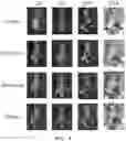 Fig. 05 - PARATHYROID HORMONE DERIVATIVE IN DIMERIC FORM OF PARATHYROID HORMONE FRAGMENT AND PHARMACEUTICAL COMPOSITION FOR PREVENTION OR TREATMENT OF BONE DISEASES COMPRISING SAME