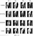 Fig. 07 - PARATHYROID HORMONE DERIVATIVE IN DIMERIC FORM OF PARATHYROID HORMONE FRAGMENT AND PHARMACEUTICAL COMPOSITION FOR PREVENTION OR TREATMENT OF BONE DISEASES COMPRISING SAME