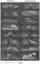 Fig. 02 - METHODS OF IMPROVING SPINAL FUSION WITH ABALOPARATIDE