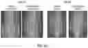 Fig. 06 - METHODS OF IMPROVING SPINAL FUSION WITH ABALOPARATIDE