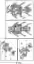 Fig. 08 - METHODS OF IMPROVING SPINAL FUSION WITH ABALOPARATIDE
