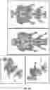 Fig. 09 - METHODS OF IMPROVING SPINAL FUSION WITH ABALOPARATIDE