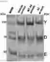 Fig. 14 - USES OF A2 DOMAIN OF VON WILLEBRAND FACTOR