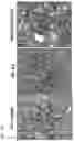 Fig. 19 - USES OF A2 DOMAIN OF VON WILLEBRAND FACTOR