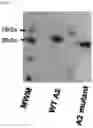 Fig. 31 - USES OF A2 DOMAIN OF VON WILLEBRAND FACTOR