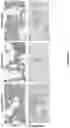 Fig. 44 - Coronavirus vaccine