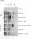 Fig. 03 - Recombinant virus with diminished latency and methods of using same