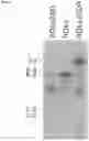 Fig. 04 - Recombinant virus with diminished latency and methods of using same