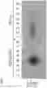 Fig. 09 - Recombinant virus with diminished latency and methods of using same