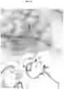 Fig. 06 - IPILIMUMAB VARIANTS WITH ENHANCED SPECIFICITY FOR BINDING AT LOW PH