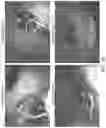 Fig. 10 - TRIGGERABLE HYDROGEL COMPOSITIONS AND RELATED METHODS