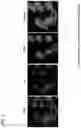 Fig. 11 - AGENT TARGETING DOUBLE-MEMBRANE ORGANELLE DNA