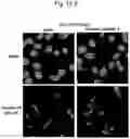 Fig. 14 - AGENT TARGETING DOUBLE-MEMBRANE ORGANELLE DNA
