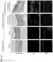 Fig. 34 - AGENT TARGETING DOUBLE-MEMBRANE ORGANELLE DNA