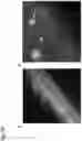 Fig. 77 - AGENT TARGETING DOUBLE-MEMBRANE ORGANELLE DNA