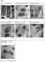 Fig. 09 - ANTIMICROBIAL TAILORED CHITOSAN
