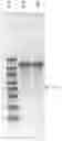 Fig. 01 - Novel Codon-Optimized CFTR MRNA
