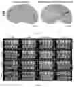 Fig. 20 - Peptide-linked drug delivery system