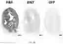 Fig. 30 - Peptide-linked drug delivery system