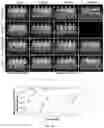 Fig. 31 - Peptide-linked drug delivery system