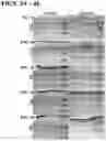 Fig. 05 - RECOMBINANT AAV-CRUMBS HOMOLOGUE COMPOSITION AND METHODS FOR TREATING LCA-8 AND PROGRESSIVE RP