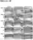 Fig. 08 - RECOMBINANT AAV-CRUMBS HOMOLOGUE COMPOSITION AND METHODS FOR TREATING LCA-8 AND PROGRESSIVE RP