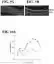 Fig. 12 - RECOMBINANT AAV-CRUMBS HOMOLOGUE COMPOSITION AND METHODS FOR TREATING LCA-8 AND PROGRESSIVE RP