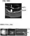 Fig. 13 - RECOMBINANT AAV-CRUMBS HOMOLOGUE COMPOSITION AND METHODS FOR TREATING LCA-8 AND PROGRESSIVE RP