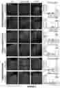 Fig. 07 - GENE THERAPY FOR TREATING OR PREVENTING VISUAL EFFECTS IN BATTEN DISEASE