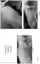 Fig. 30 - METHOD FOR ENHANCING TUMOR GROWTH