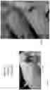 Fig. 33 - METHOD FOR ENHANCING TUMOR GROWTH
