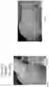 Fig. 34 - METHOD FOR ENHANCING TUMOR GROWTH