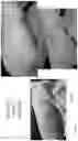 Fig. 37 - METHOD FOR ENHANCING TUMOR GROWTH
