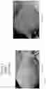 Fig. 41 - METHOD FOR ENHANCING TUMOR GROWTH