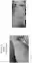 Fig. 46 - METHOD FOR ENHANCING TUMOR GROWTH