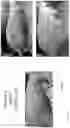 Fig. 47 - METHOD FOR ENHANCING TUMOR GROWTH