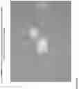 Fig. 61 - METHOD FOR ENHANCING TUMOR GROWTH