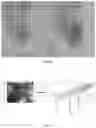 Fig. 03 - Bleeding Detection Method