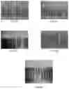 Fig. 05 - Bleeding Detection Method